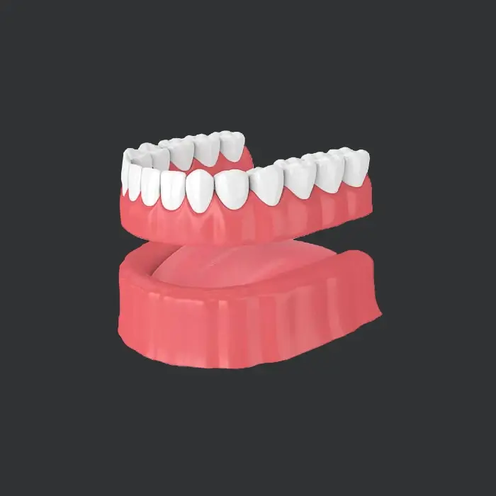 model of traditional dentures