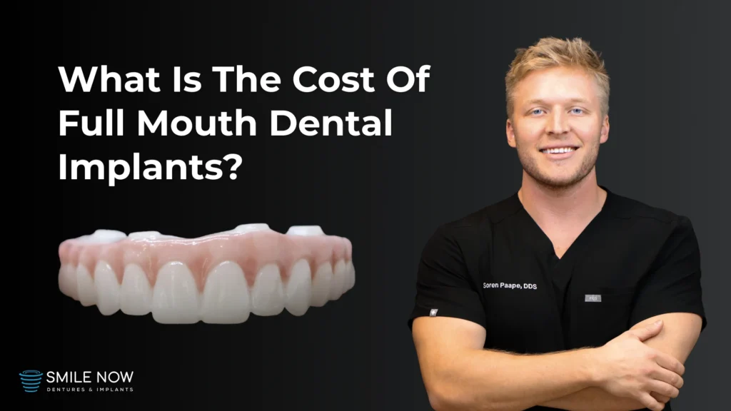 Video thumbnail for What is the cost of full mouth dental implants?