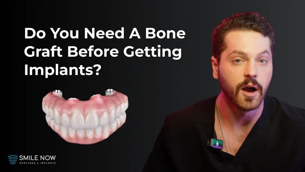 Thumbnail for video about getting a dental bone graft before implants