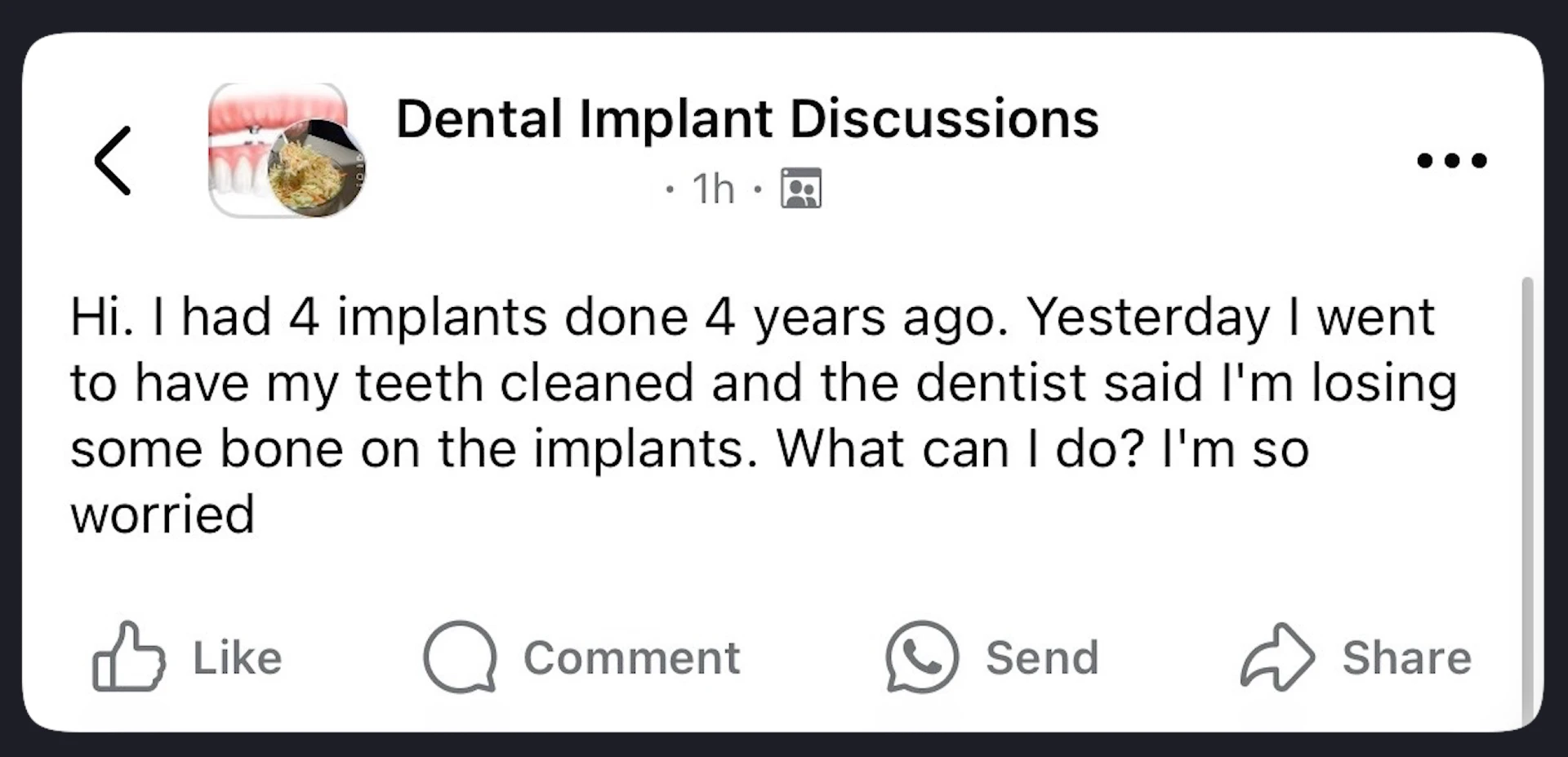 Patient question about dental implants problems: bone loss.