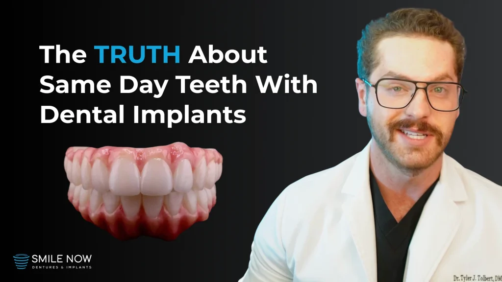 Thumbnail image for a video going over the truth about same day teeth implants.