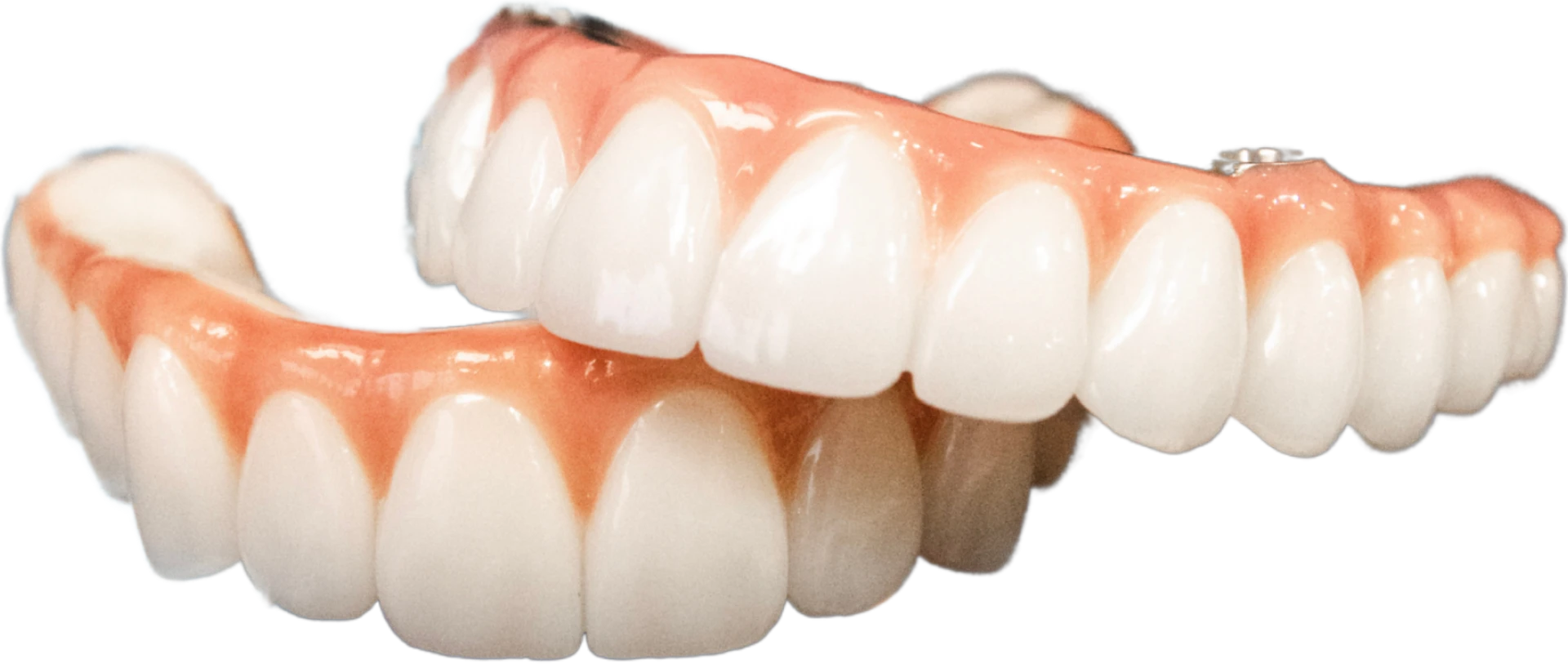 Model of provisional same day teeth implants stacked on top of each other.