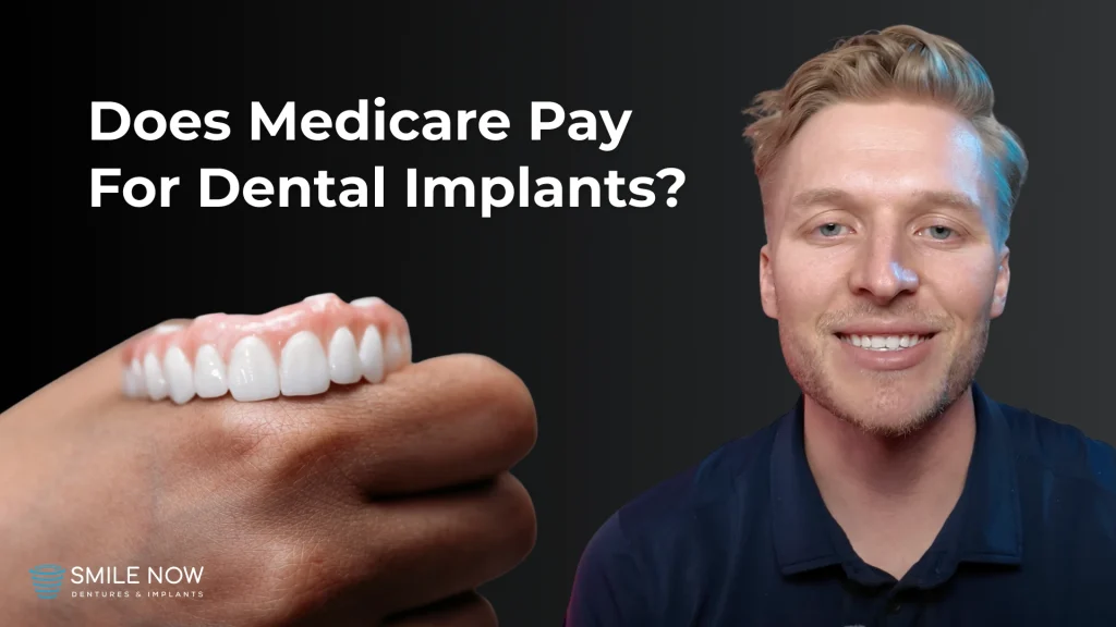 Thumbnail image for a video that answers the question, "Does Medicare pay for dental implants?"